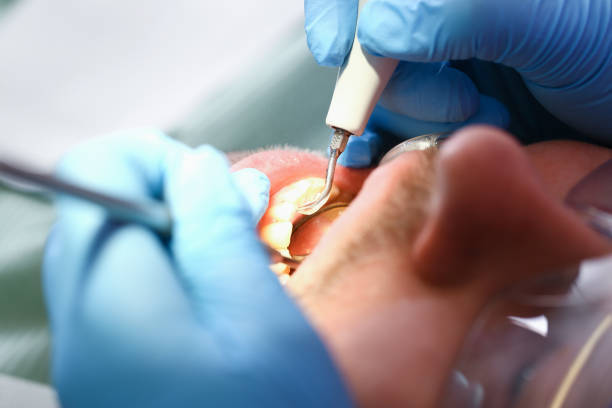 Best Broken or Cracked Tooth Emergency Dentist in Defuniak Springs, FL