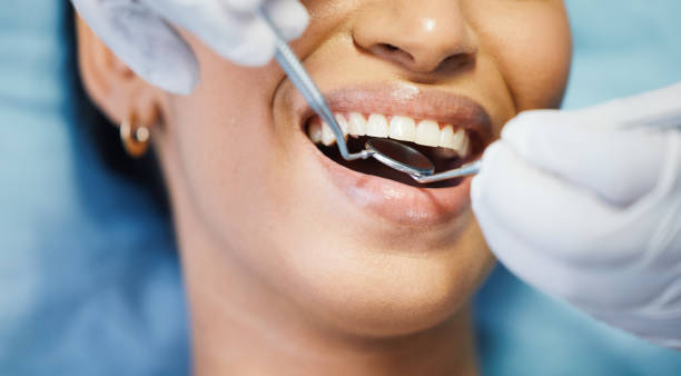 Best Emergency Dentist for Lost Fillings or Crowns in Defuniak Springs, FL